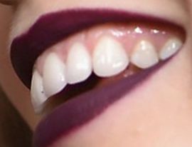 Picture of Abbey Lee Kershaw teeth and smile
