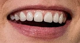Picture of Abbey Lee Kershaw teeth and smile