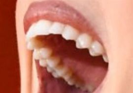 Adele smile and teeth