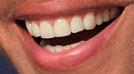 Picture of Alex Rodriguez teeth and smile