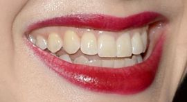 Picture of Alexandra Daddario teeth and smile