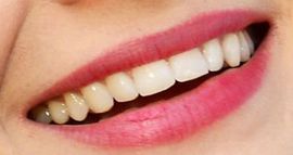 Picture of Alexis Bledel teeth and smile