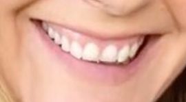 Picture of Alicia Silverstone teeth and smile