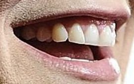 Picture of Alicia Silverstone teeth and smile