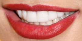 Picture of Amy Jackson teeth and smile
