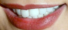 Picture of Amy Jackson teeth and smile