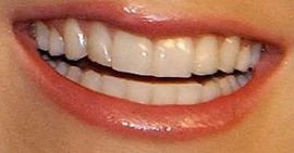 Picture of Anna Faris teeth and smile
