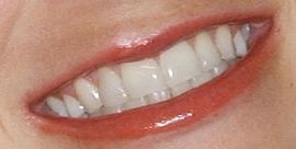 Picture of Anna Faris teeth and smile