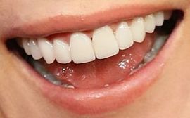 Picture of Anna Freil healthy teeth and smile