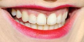 Picture of Anna Paquin healthy teeth and smile
