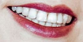 Picture of Anya Taylor-Joy teeth and smile