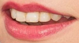 Picture of Anya Taylor-Joy teeth and smile