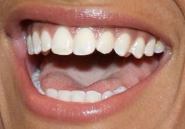 Picture of Ariana DeBose teeth and smile