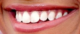 Picture of Ariana DeBose teeth smile