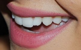 Picture of Ariana Grande's teeth and smile while smiling