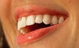Picture of Ashley Cooke teeth and smile