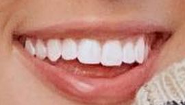 Picture of Ashley Cooke teeth and smile