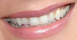 Picture of Avril Lavigne teeth and smile