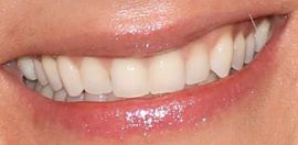 Picture of Avril Lavigne teeth and smile