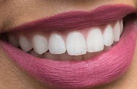 Picture of Ayesha Curry teeth and smile
