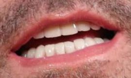Picture of Ben Affleck healthy teeth and smile