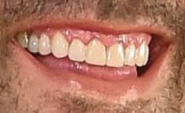Picture of Ben Affleck healthy teeth and smile
