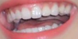 Picture of Blackpink Jennie Kim's healthy teeth and smile