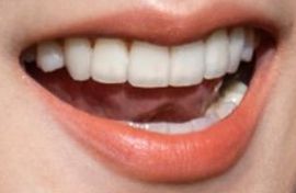 Picture of Blackpink Jisoo's healthy teeth and smile