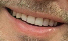 Brad Pitt's teeth and smile