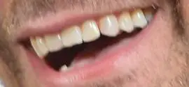 Picture of Bradley Cooper healthy teeth and smile