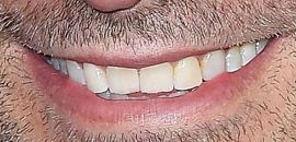Picture of Bradley Cooper healthy teeth and smile