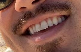 Picture of Bryan Tanaka teeth and smile