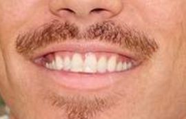 Picture of Bryan Tanaka teeth and smile