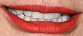 Picture of Cameron Diaz teeth and smile