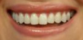 Picture of Camille Vasquez's healthy teeth and winning smile