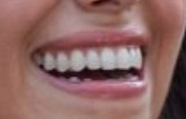 Picture of Camille Vasquez's healthy teeth and winning smile