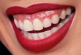 Picture of Cassey Ho of Blogilates teeth and smile