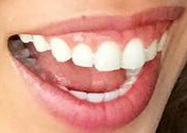 Picture of Cassey Ho of Blogilates teeth and smile