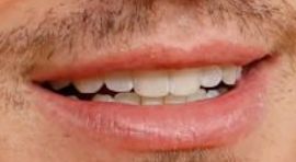 Picture of Charlie Puth teeth and smile
