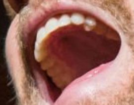 Picture of Chase Rice teeth and smile