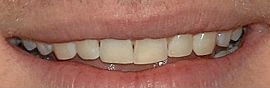 Chris Hemsworth teeth