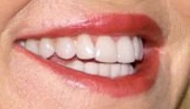 Picture of Christie Brinkley teeth and smile