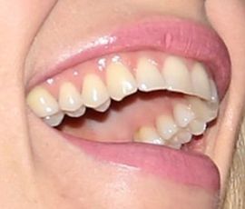 Picture of Claire Danes teeth and smile