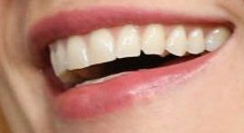 Picture of Claire Danes teeth and smile