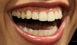 Picture of Corinne Foxx teeth and smile