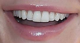 Picture of Crystal Hefner teeth and smile