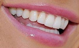 Picture of Crystal Hefner teeth and smile