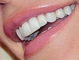 Picture of Crystal Hefner teeth smile