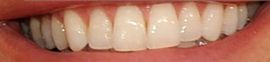 Picture of Crystal Hefner teeth smile