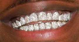 Picture of DaBaby teeth and smile